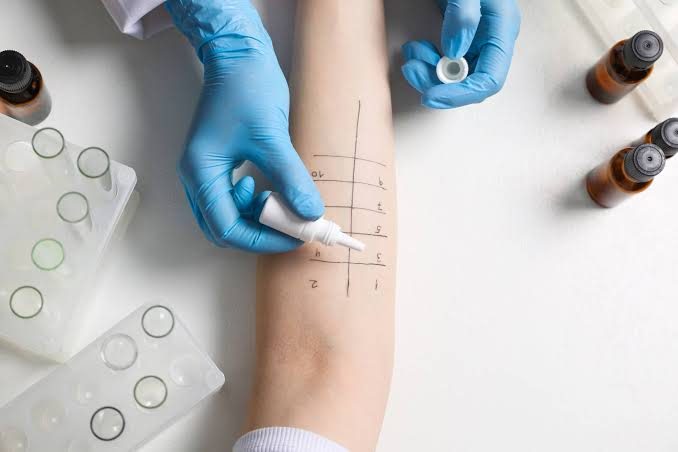 Alergia e imunologia
