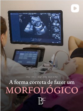 Ultrassom morfol&oacute;gico realizado no consult&oacute;rio da Dra. Bruna Facco
