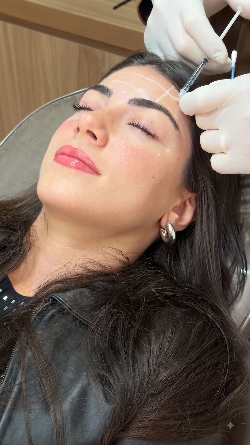 Dermatologia estética